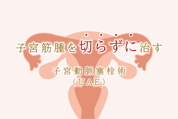 子宮筋腫を「切らずに治す」子宮動脈塞栓術（UAE）